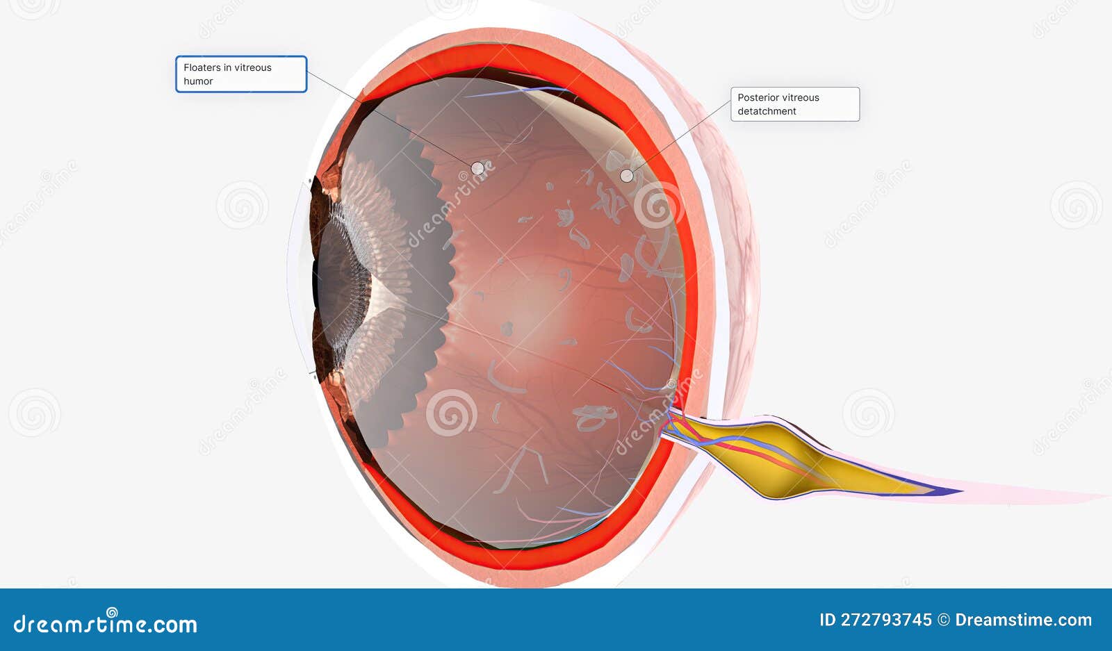 Floaters are Small Spots in Your Field of Vision Stock Illustration