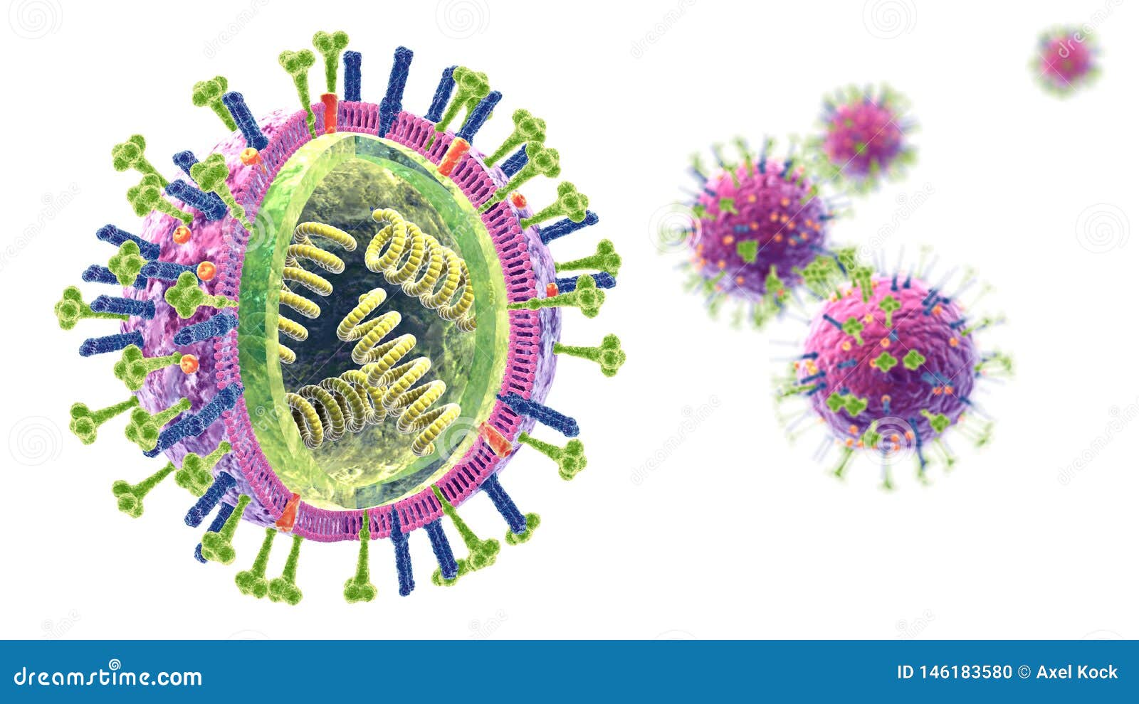 flu. influenza viruses with rna, surface proteins hemagglutinin and neuraminidase,  medically 3d 