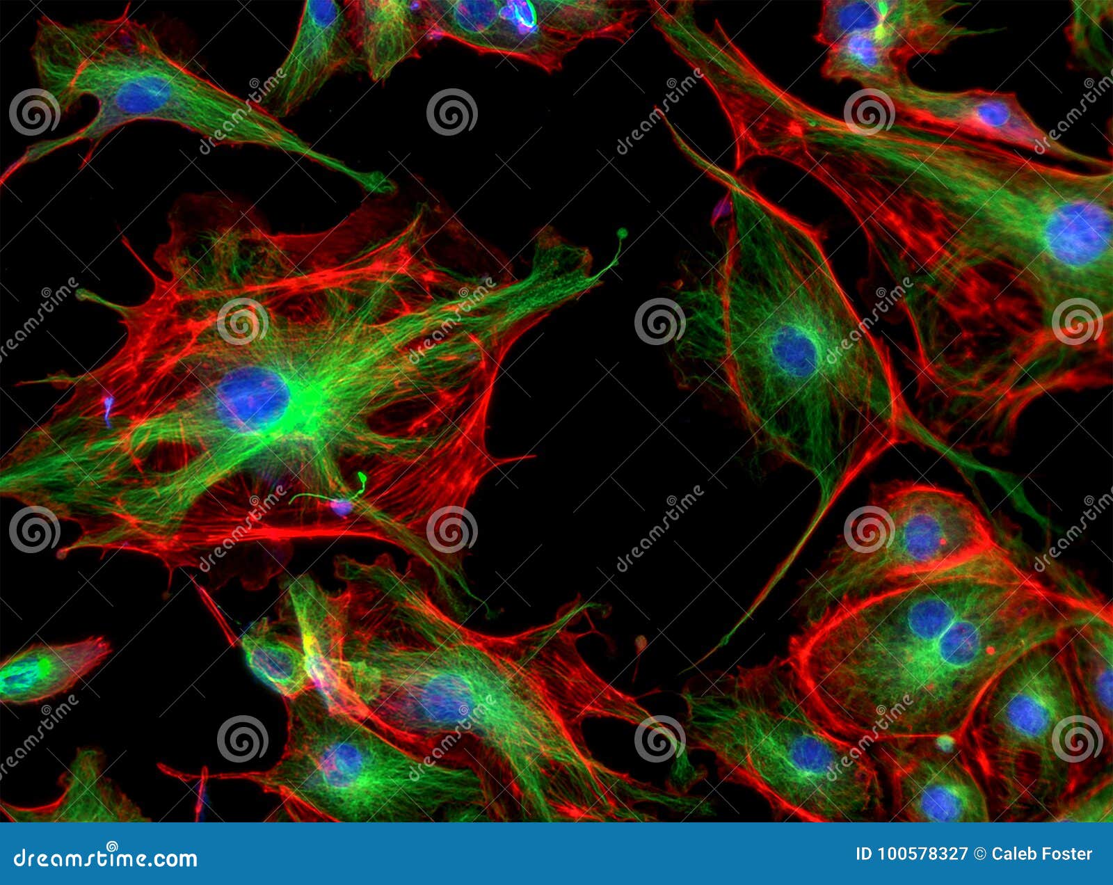 fluorescence microscope image of cells undergoing mitosis