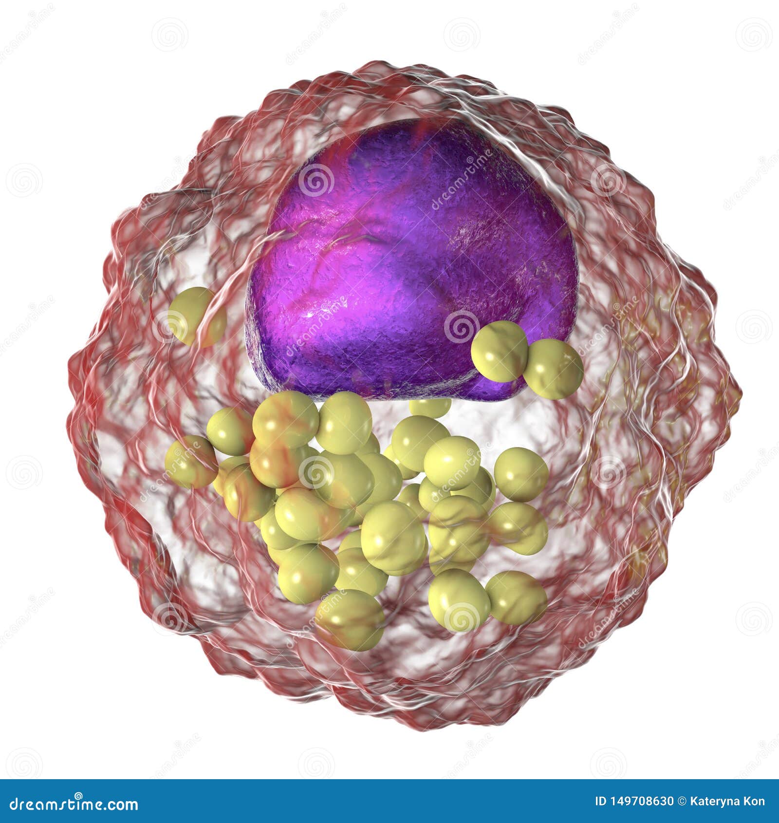Foam Cell Macrophage Cells That Contain Lipid Droplets Stock Illustration Illustration Of Plaque Protein 149708630