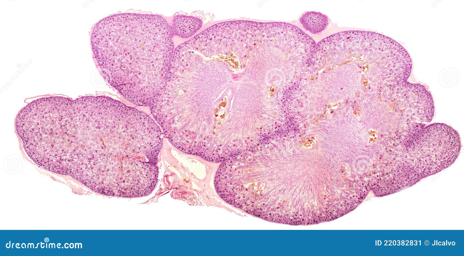 foetal kidney cortex and medulla