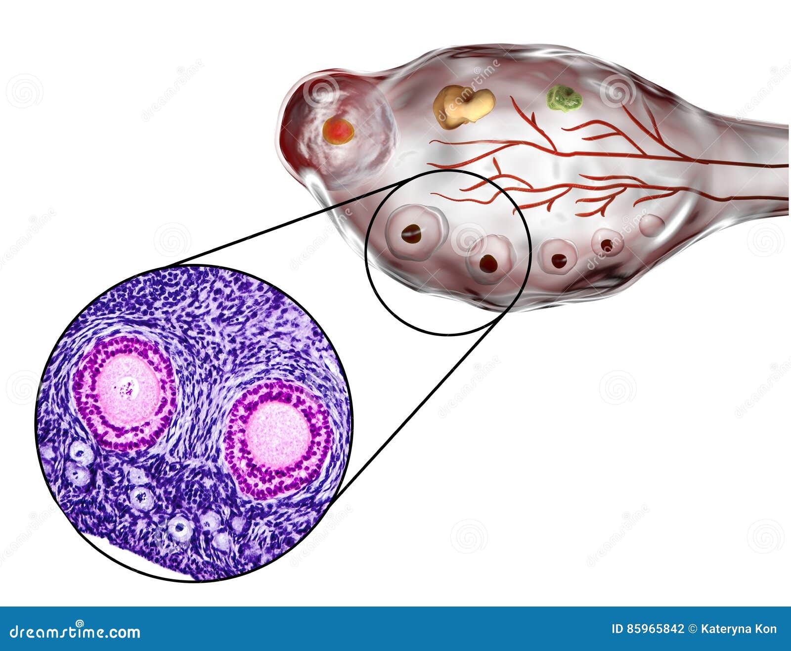 Quanti Follicoli Dopo 5 Giorni Di Stimolazione Follicoli, Micrografo Ed Illustrazione Ovarici Illustrazione di Stock