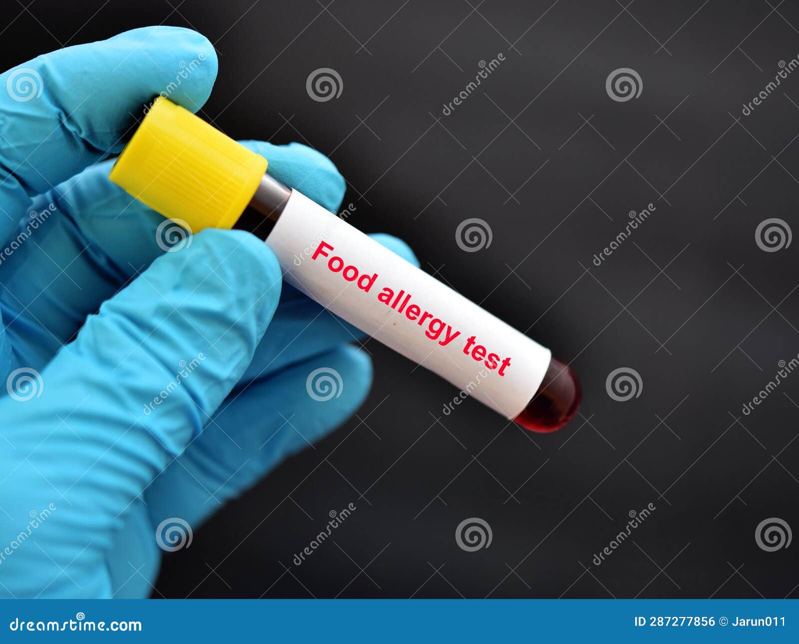 Food Allergy Blood Test Stock Photo Image Of Pork Inhalation 287277856 food-allergy-blood-test-stock-photo-image-of-pork-inhalation-287277856