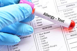 Allergy Food Stock Photo CartoonDealer 73884582