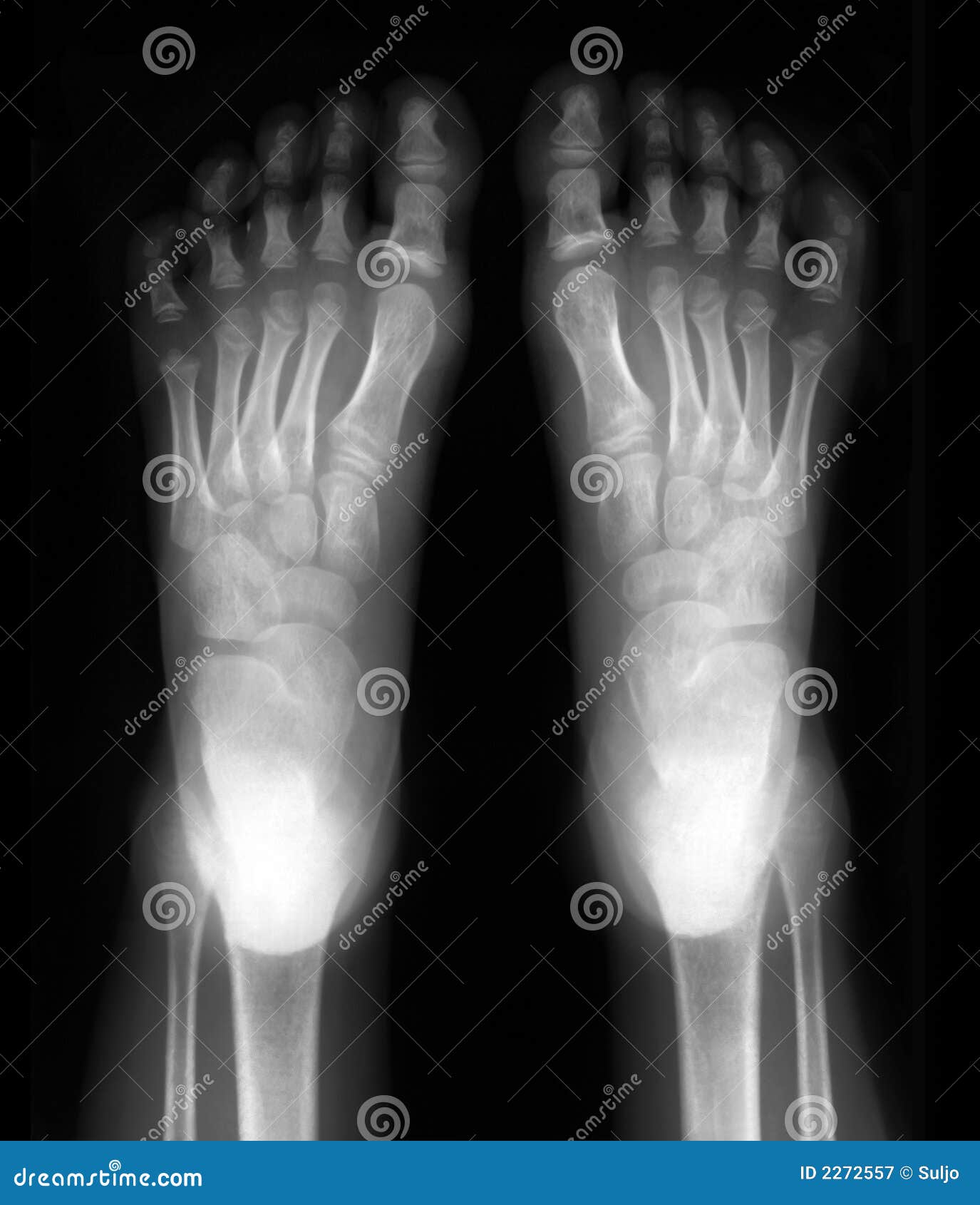 Foot stock image. Image of hands, medicine, arthritic 2272557