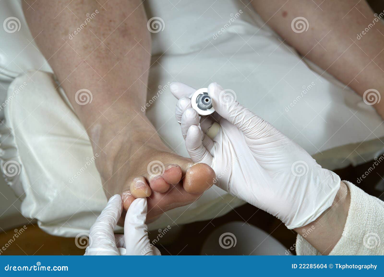 Foot Care Pedicure Chiropody Stock Photo Image of skin, therapy