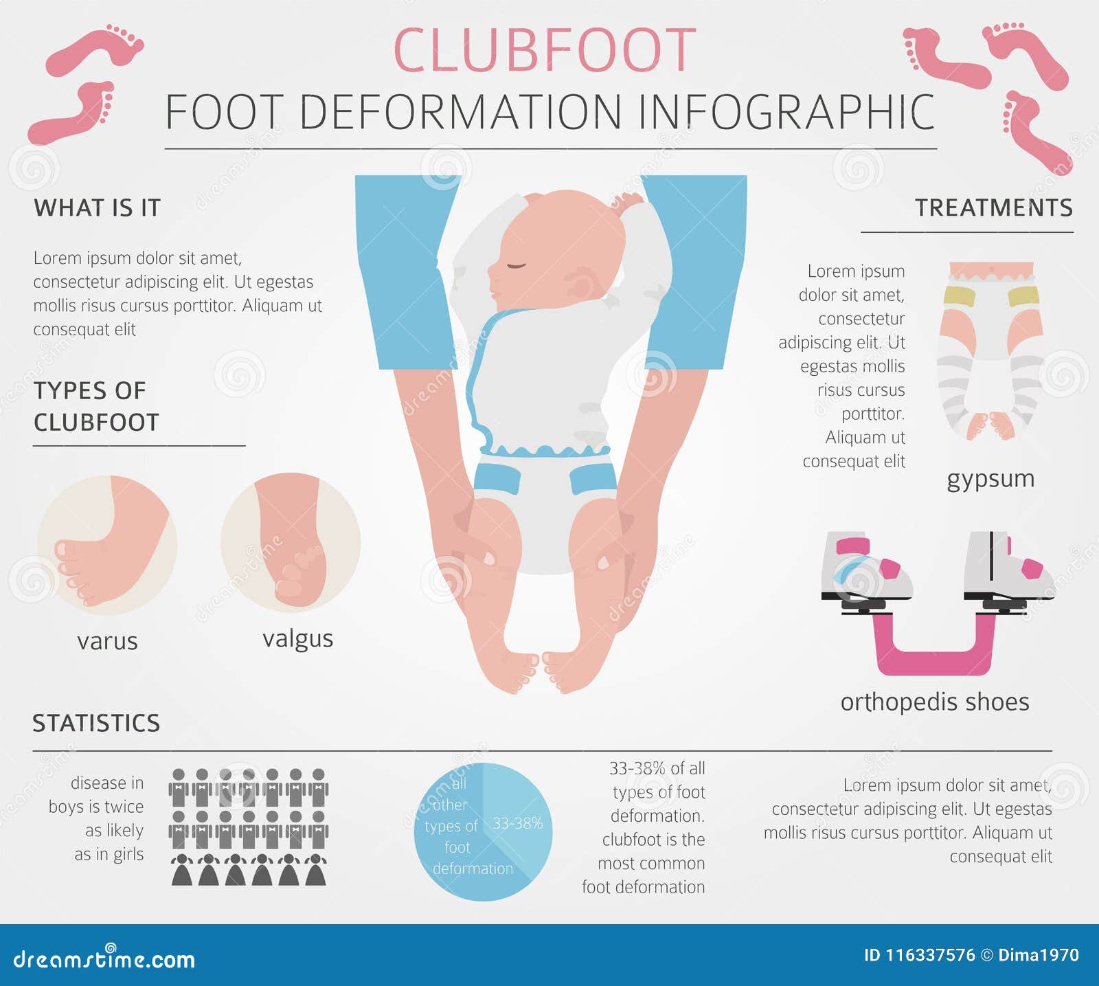 Clubfoot Stock Illustrations 96 Clubfoot Stock Illustrations Vectors Clipart Dreamstime