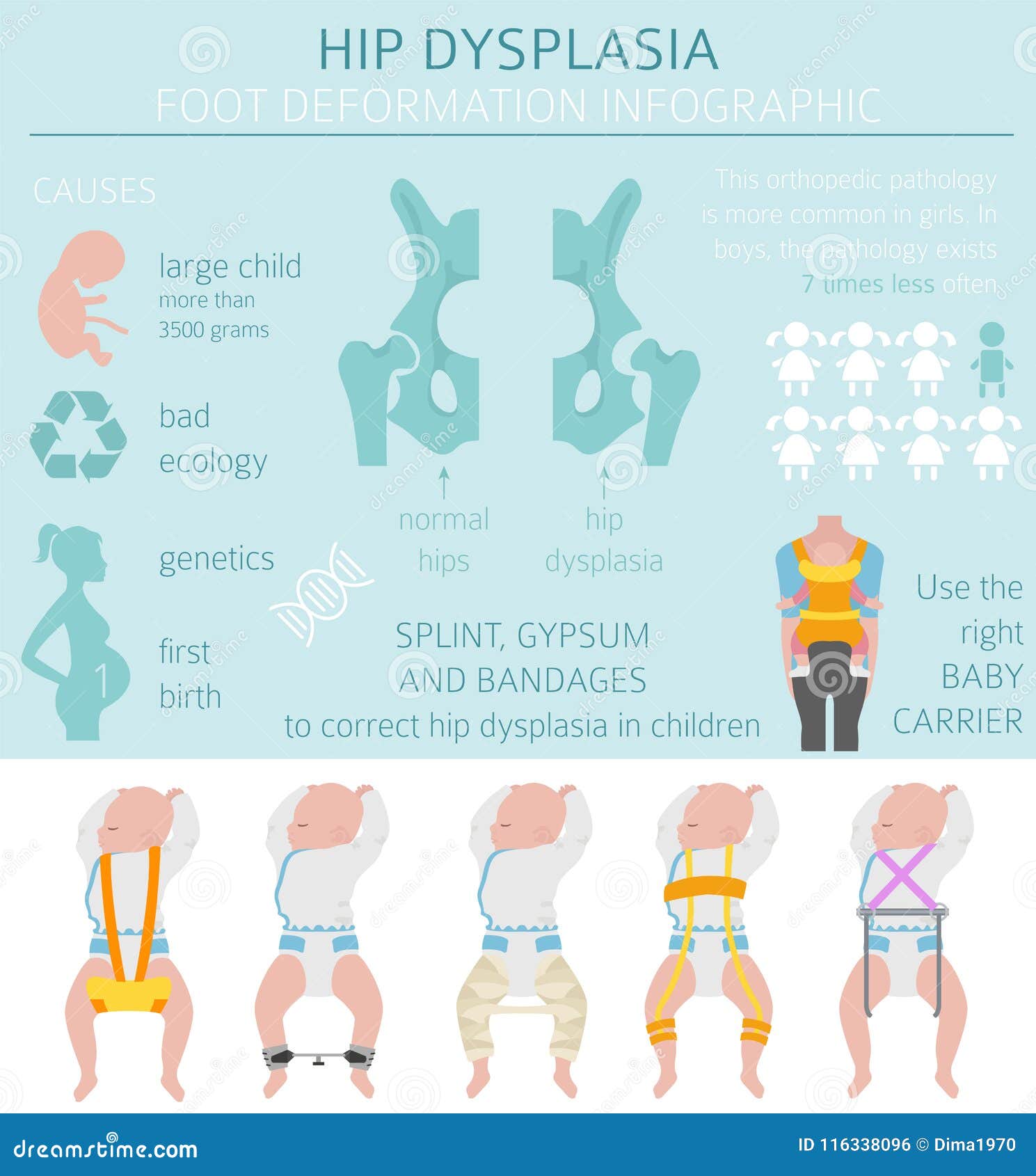 Foot Types Chart