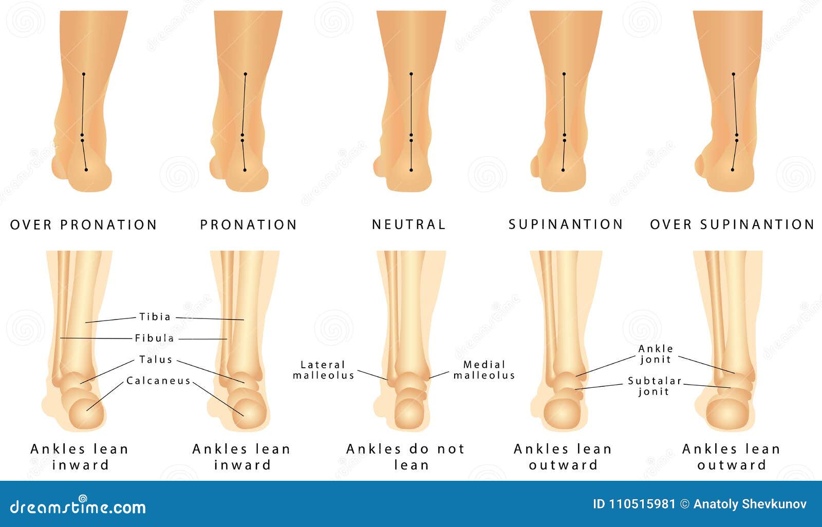 Varus Valgus Knee Deformity