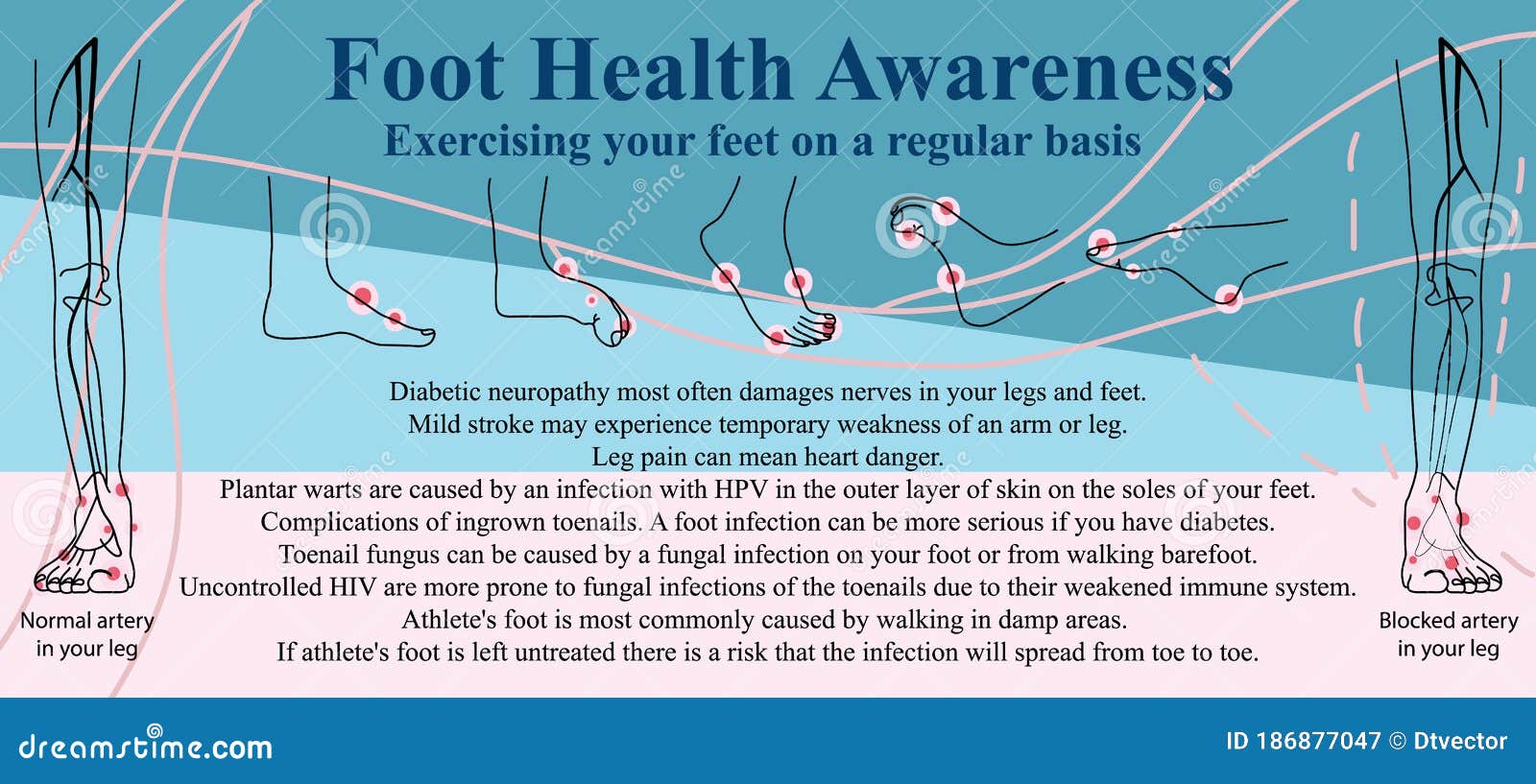 Foot Health Awareness Banner Stock Vector Illustration of pose