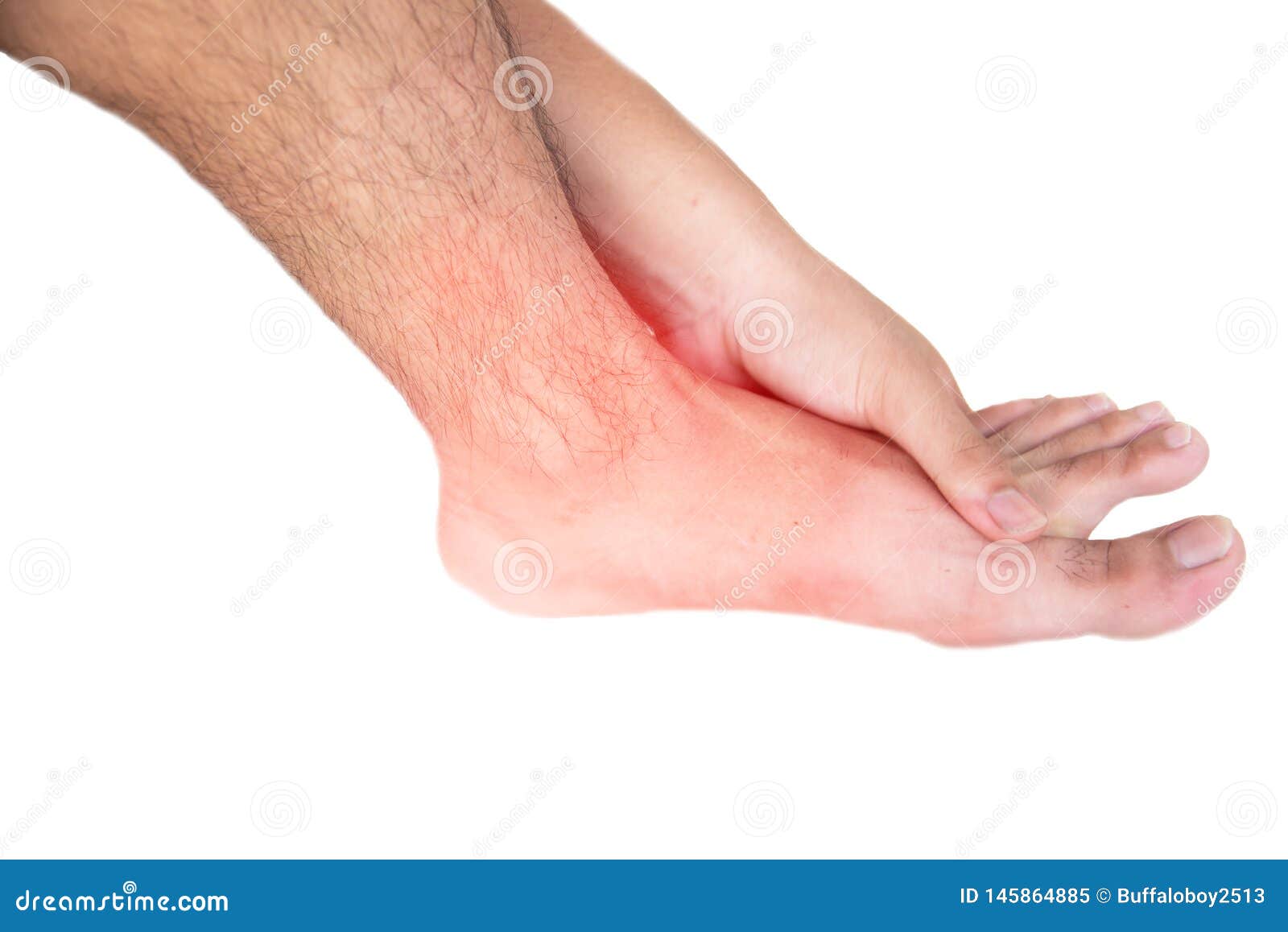 Foot injury stock image. Image of sport, pain, concept 145864885