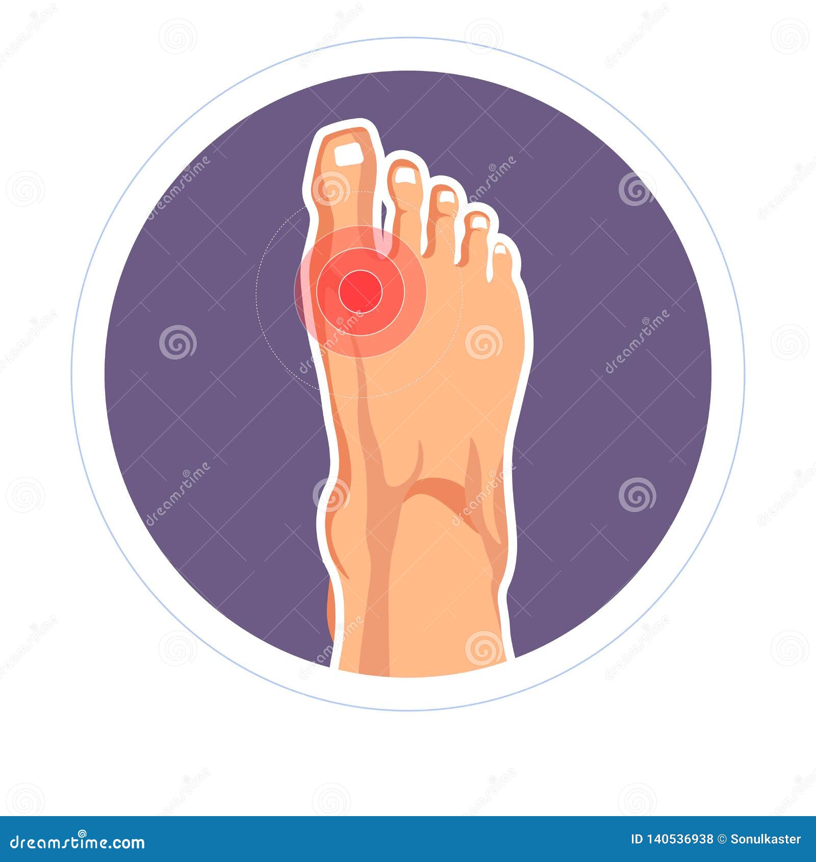 foot joint injury toe pain arthritis or skeletone damage