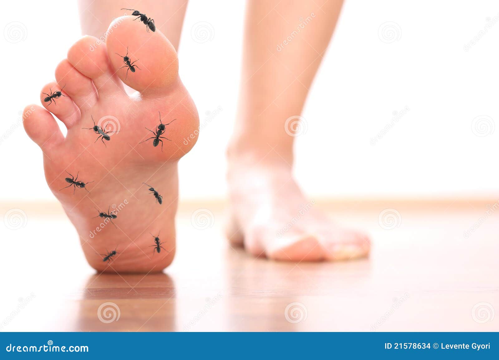 foot stepping ant chicle diabetes leg