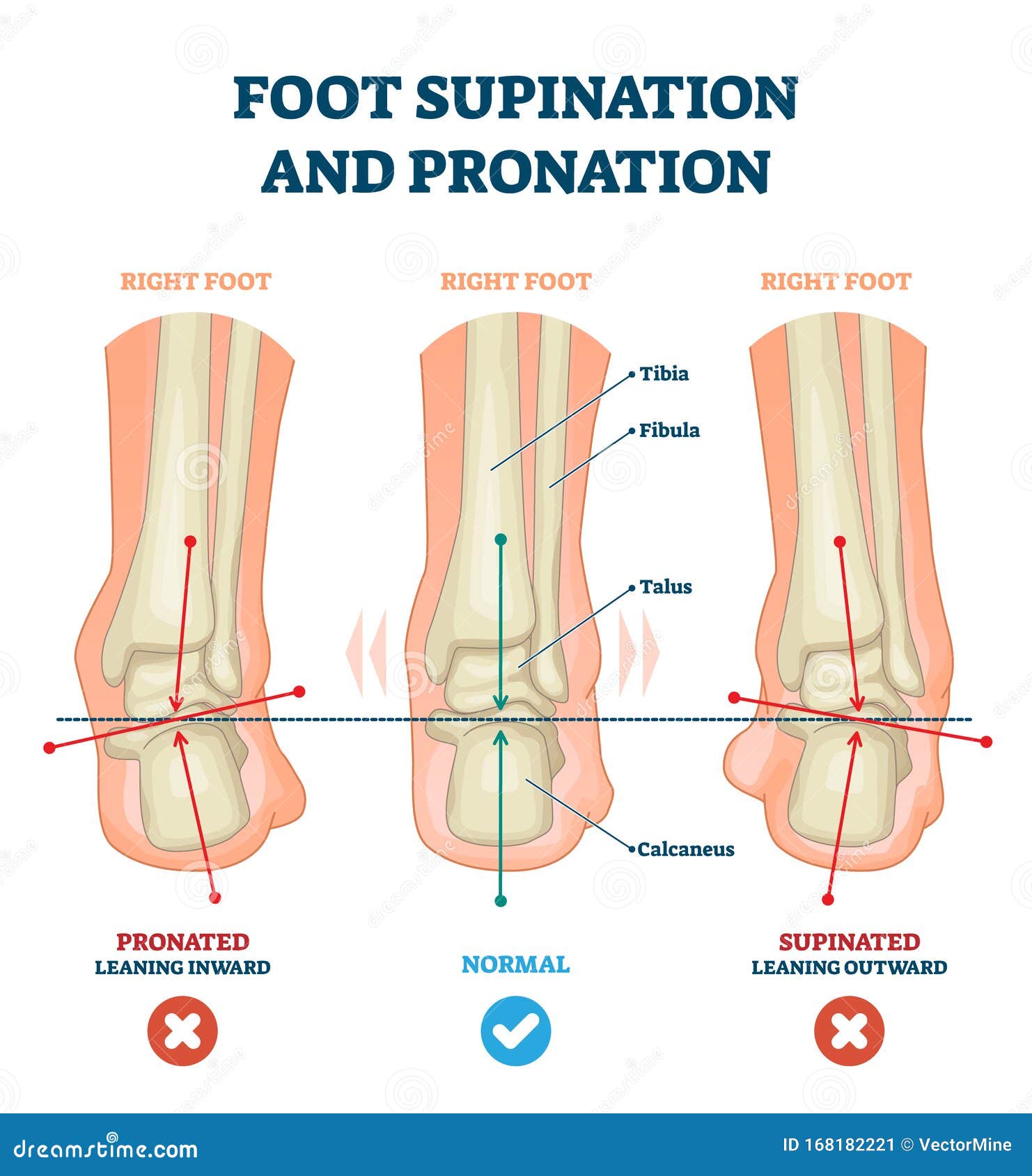 foot supination and pronation  . labeled medical scheme.