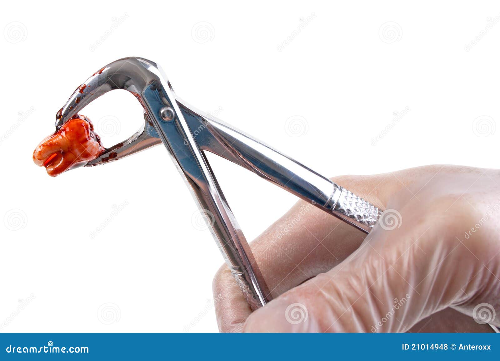 Forceps et dent dentaires photo stock. Image du outil 21014948