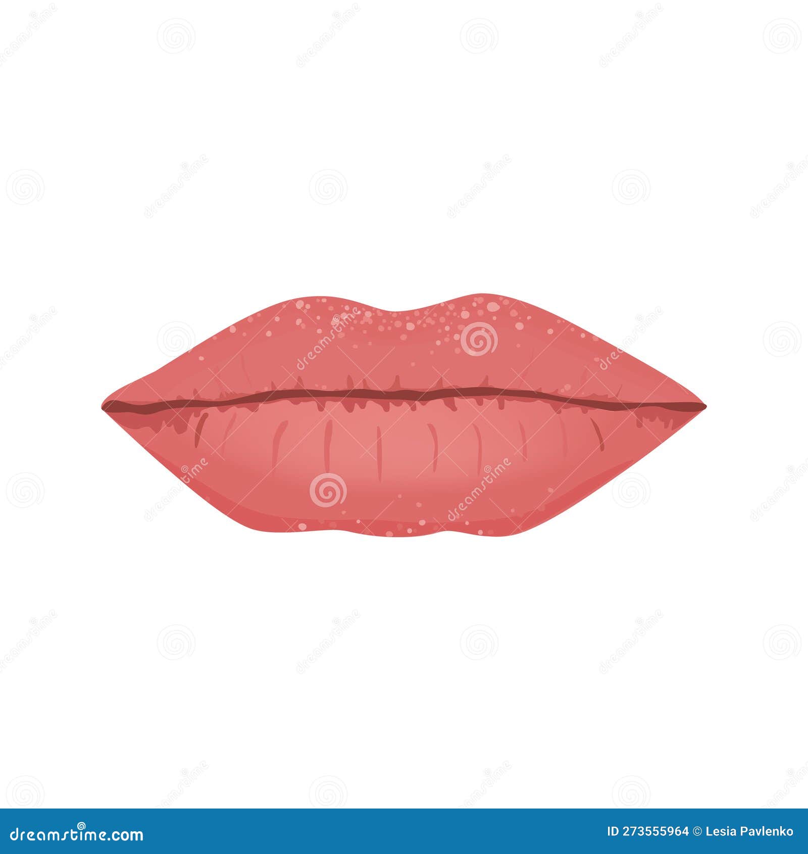 Fordyce Spots on Lips, Isolated Vector Illustration. Fordyce Granules Stock Vector
