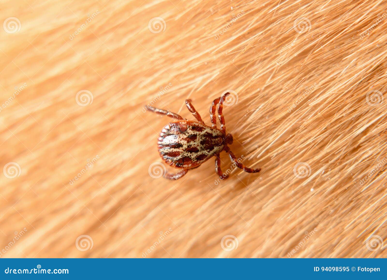 Forest Mite on Dog Hair. Tick Stock Image Image of hand, feed 94098595