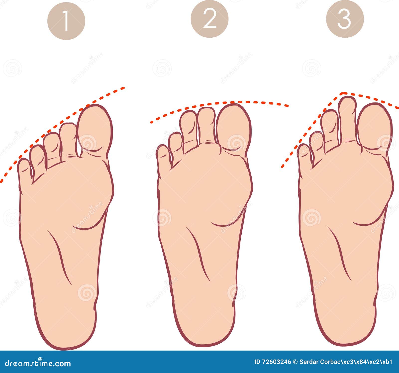 formlessness of toes