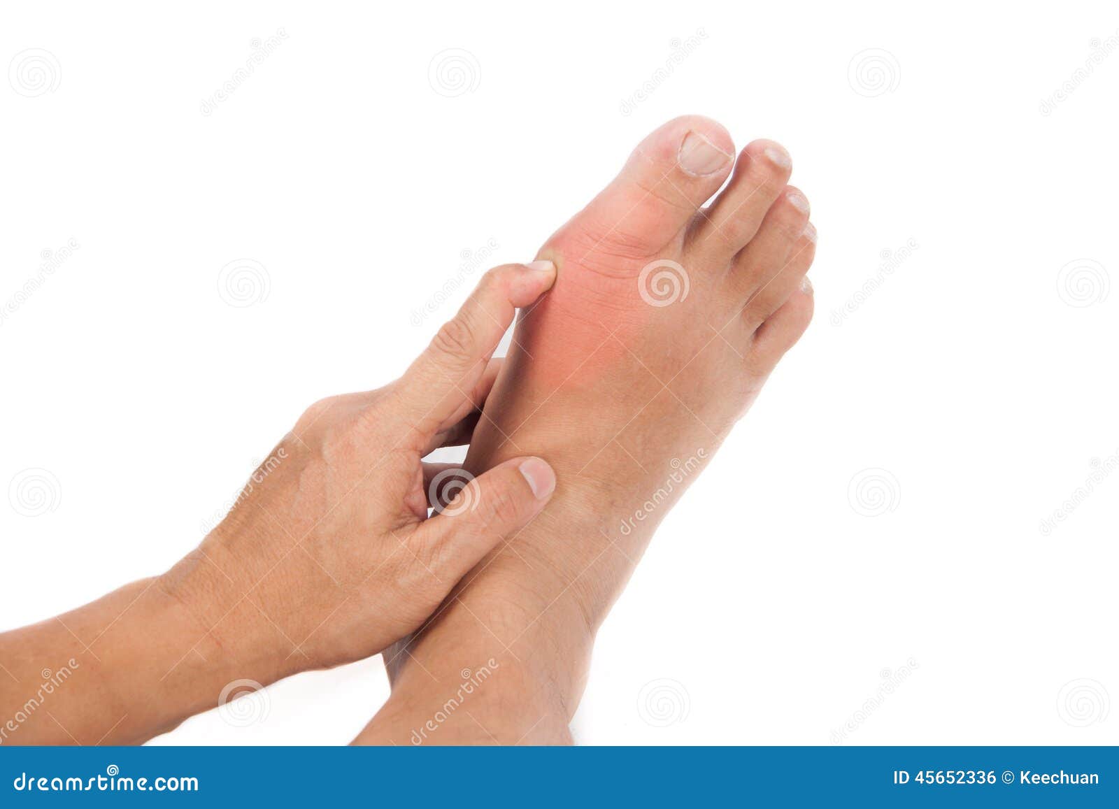 inflammation i foten inflammation i foten