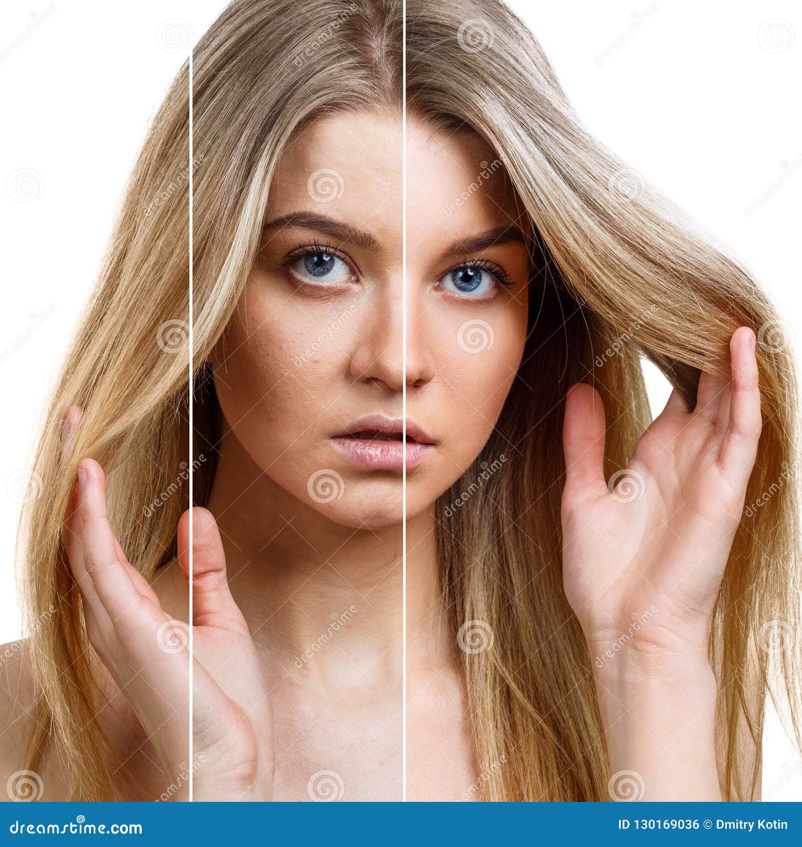 Frauengesicht Mit Teil Mit Akne Vor Und Nach Make Up Stockfoto Bild Von Teil Akne