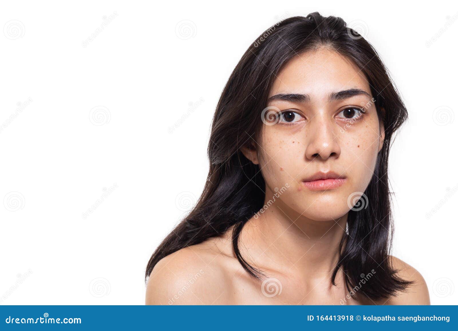 freckles, blemish, pimple, acne and dull skin on her beautiful asian face. asian woman gets sad, beautiful young woman get problem