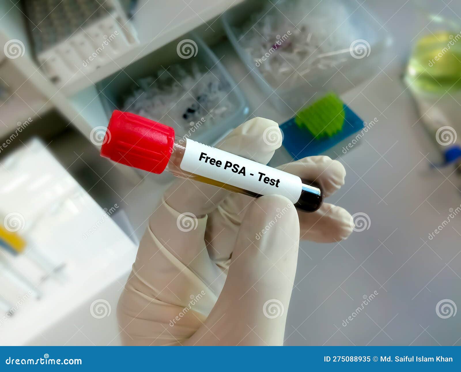 Free PSA Test. Diagnosis of Prostate Cancer Stock Image Image of