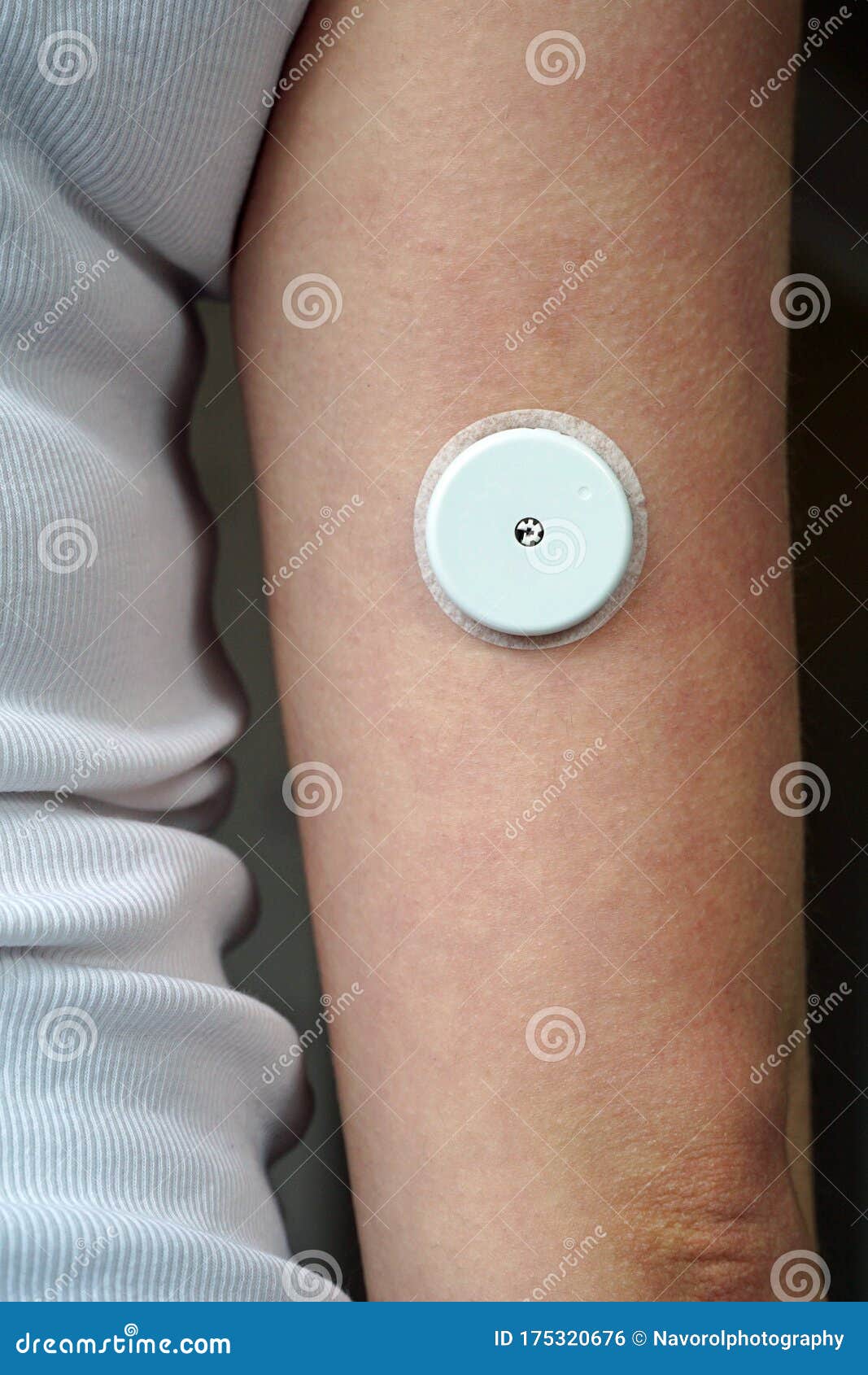 freestyle libre sensor on an arm