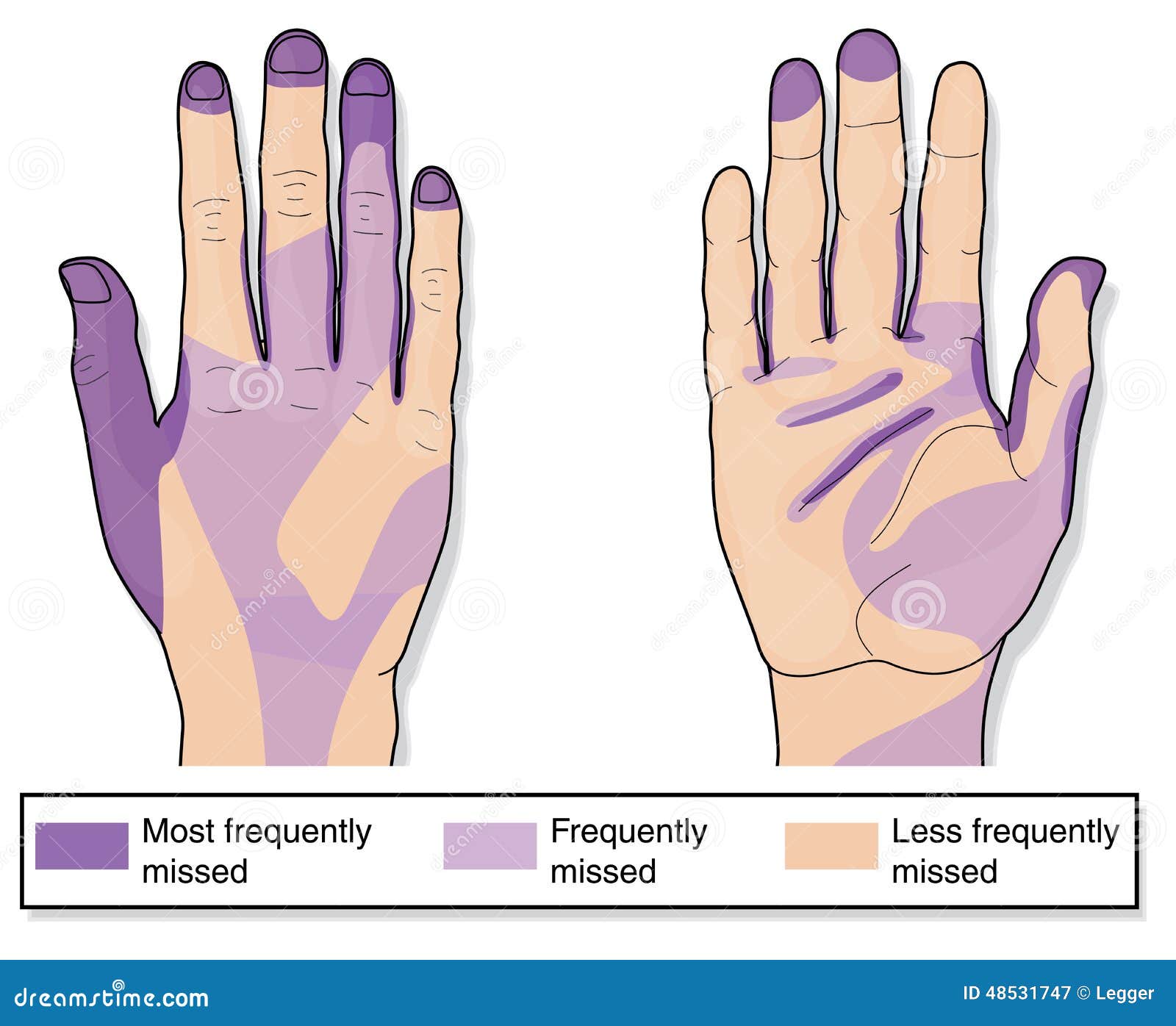 frequently missed areas when cleaning hands