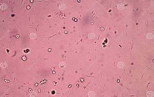 Fresh Bacteria In Urine Exam Stock Photo CartoonDealer 67925850