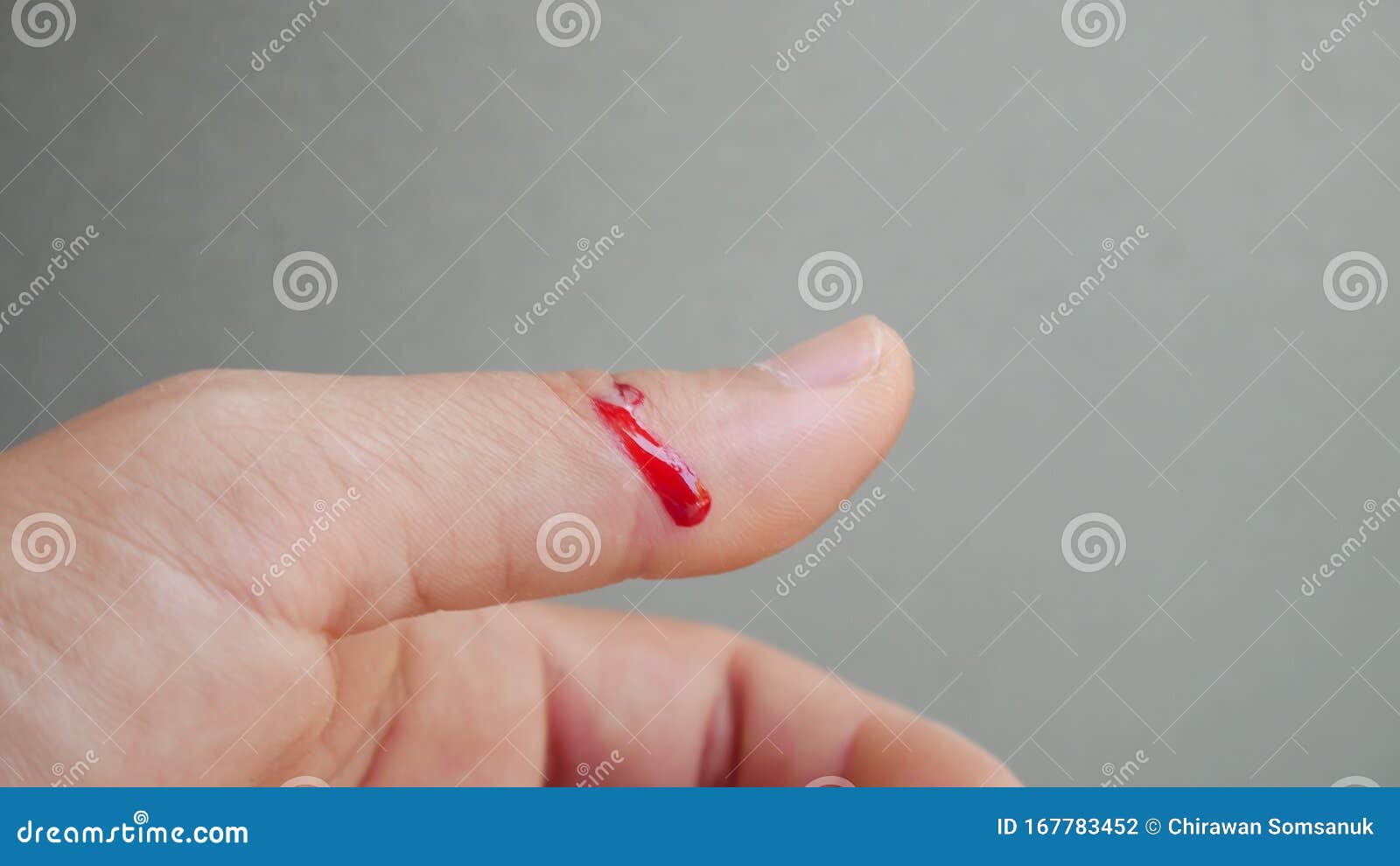 Fresh Wound with Blood in Finger Stock Photo - Image of clean ...