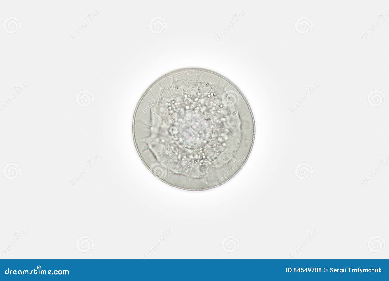freshwater phytoplankton round diatom algae stephanodiscus by microscope. bacillariophyta cyclotella kutzingiana