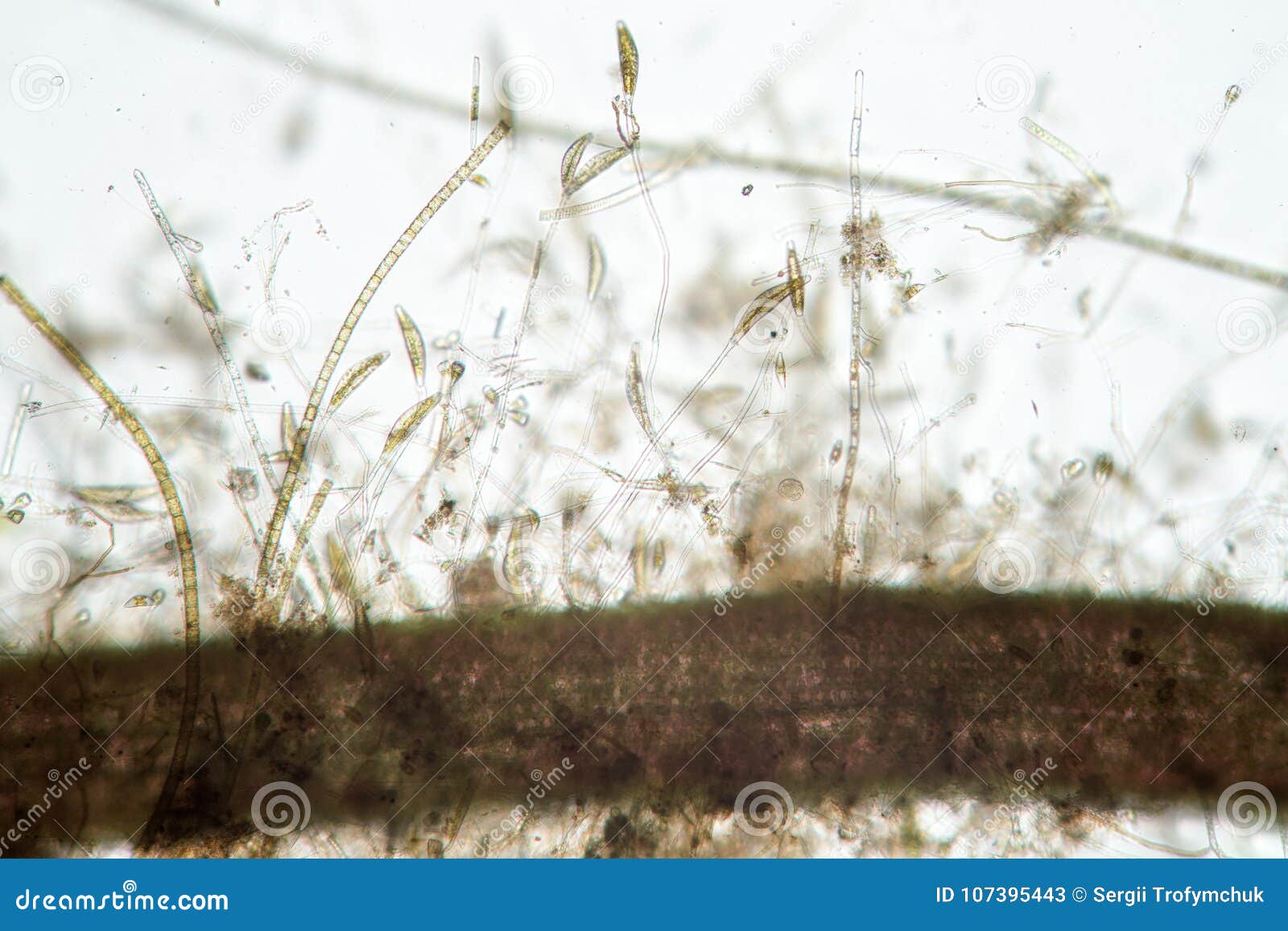 banana-d ciliated organism is protozoa diatom algae exoskeleton by microscope. hornwort or coontails algae fouling with unice