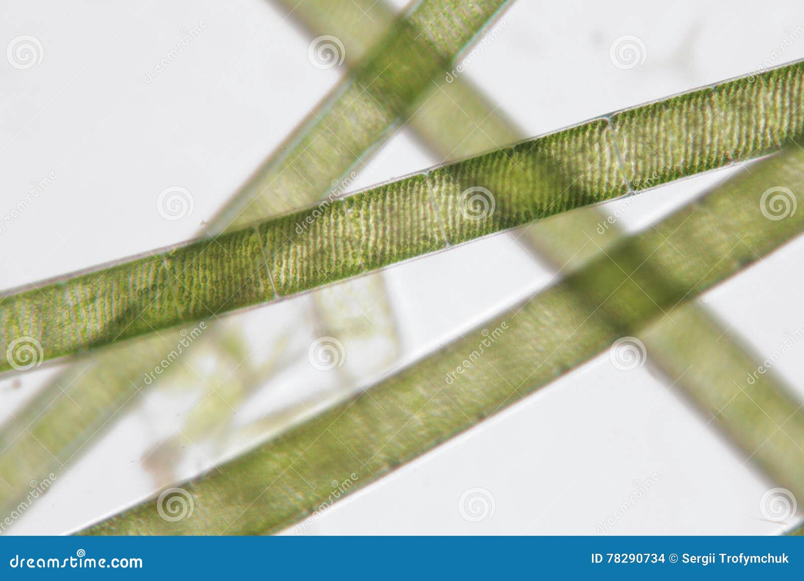 freshwater spirogyra. filamentous charophyte green algae order zygnematales. spiral chloroplasts