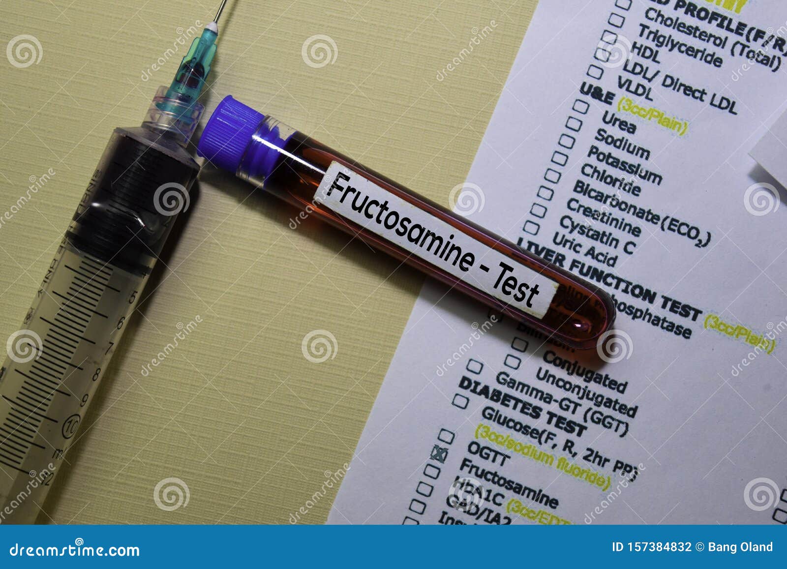 Fructosamine Test with Blood Sample. Top View Isolated on Office Desk Fructosamine Test with Blood Sample. Top View Isolated on Office Desk