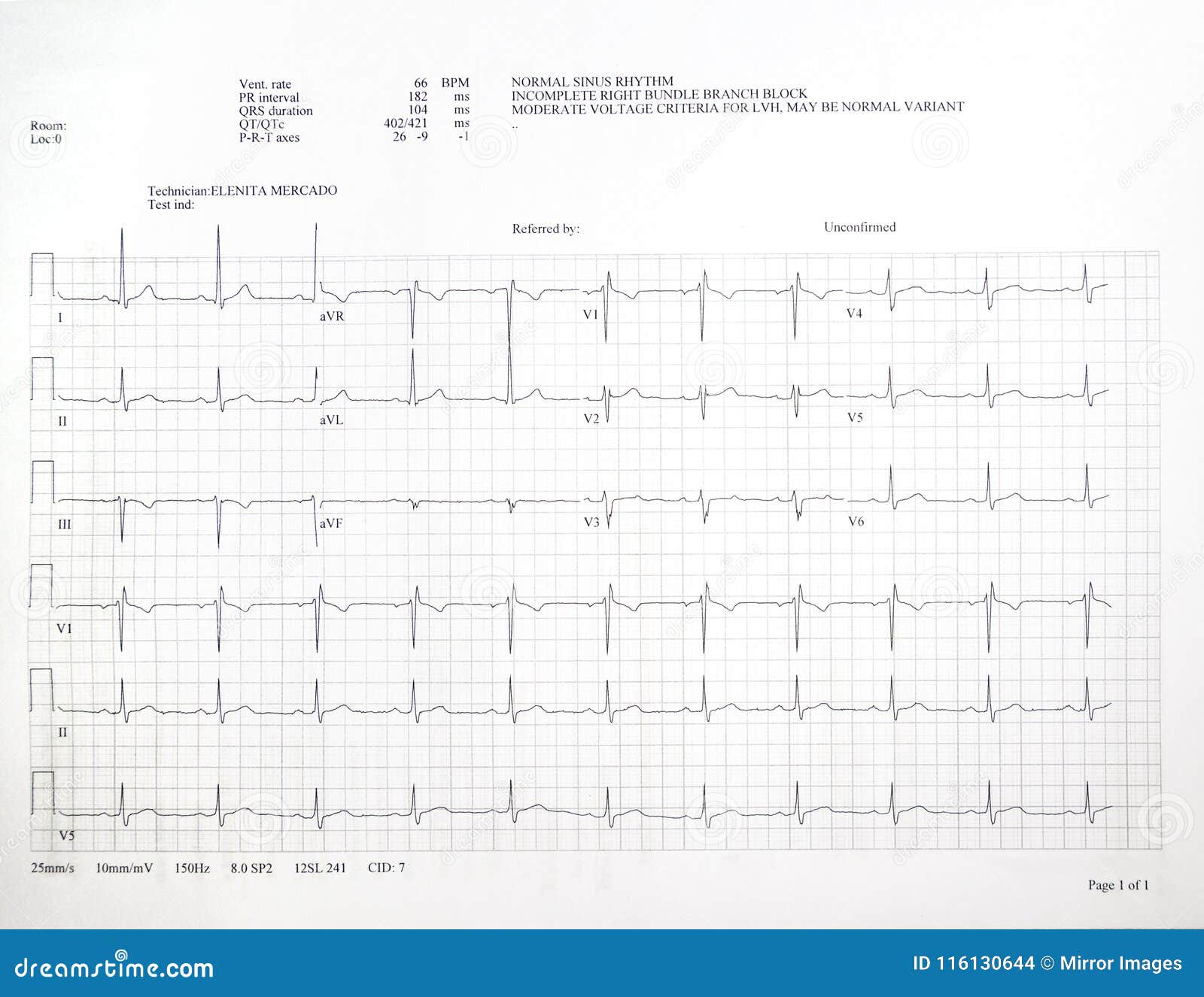 Cardiac Chart