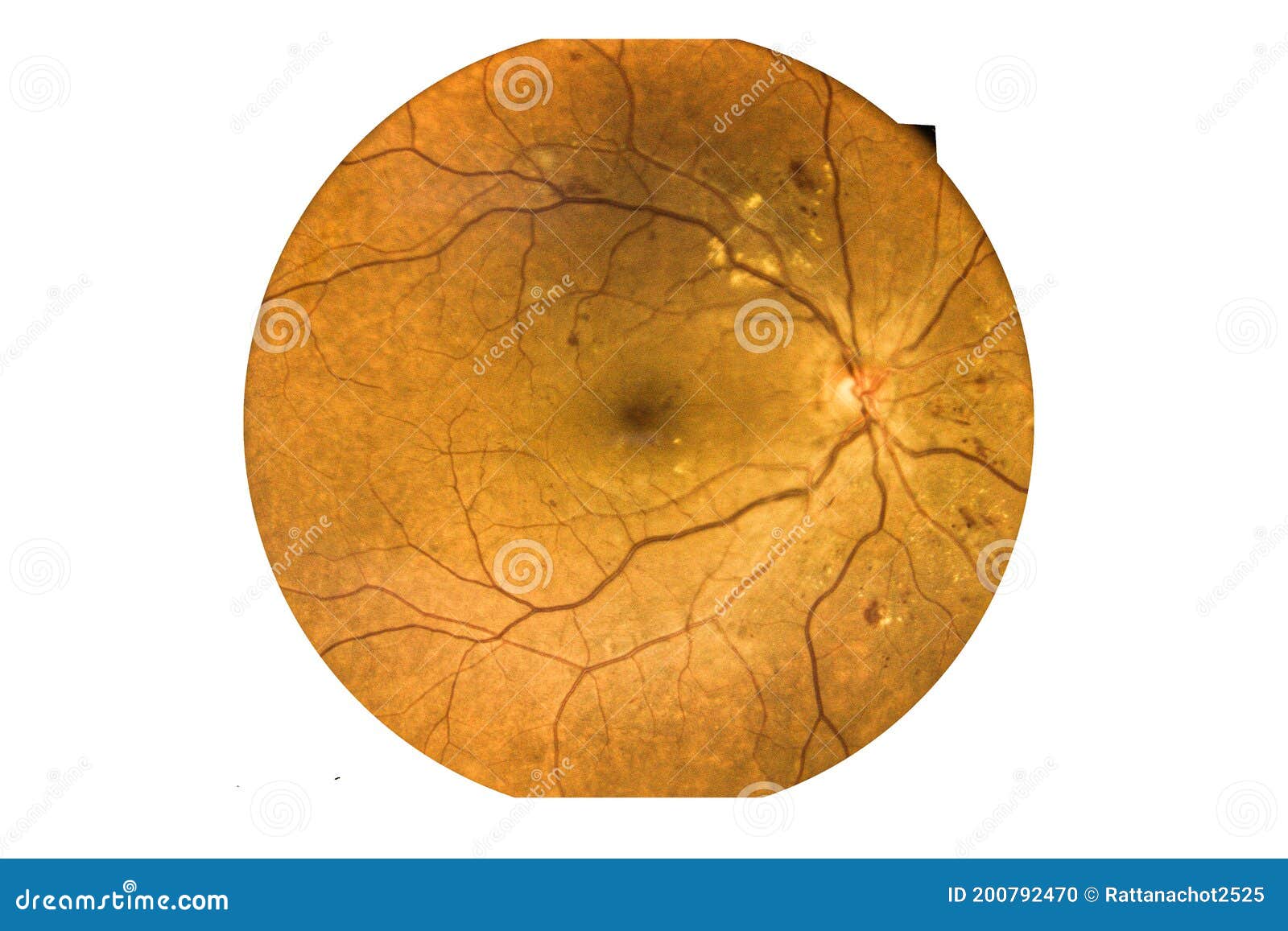 Retina Imaging  Village Optical