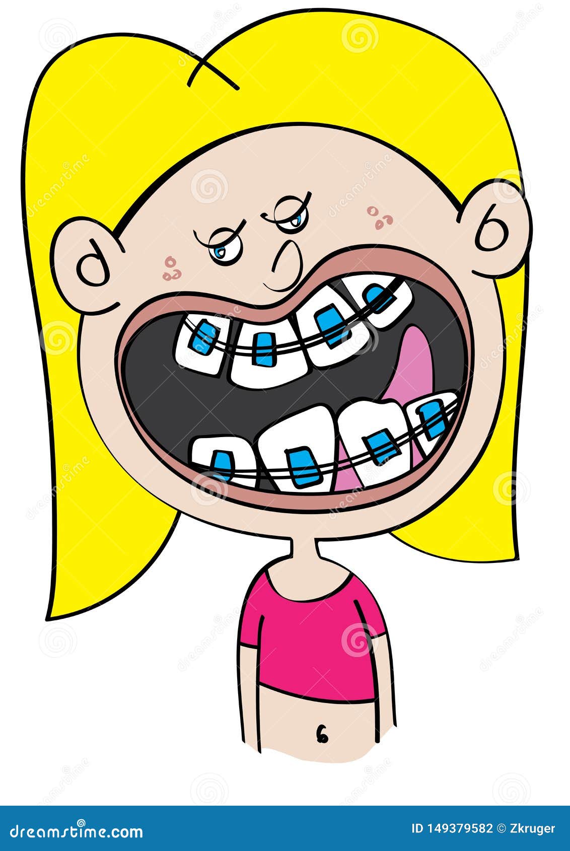 Funny White Girl with Dental Braces Cartoon Stock Vector - Illustration of  white, structural: 149379582