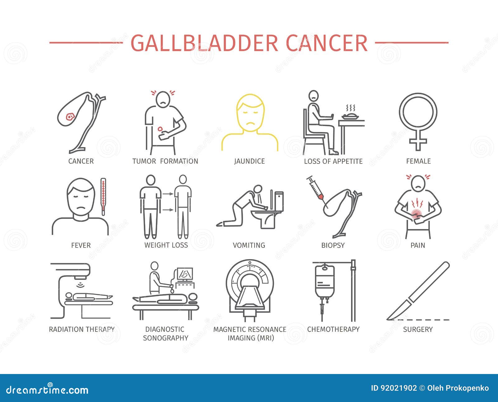 Gallbladder Cancer. Symptoms, Treatment. Line Icons Set. Vector Signs Stock Illustration - Illustration of female, cancer: 92021902 Gallbladder Cancer. Symptoms, Treatment. Line Icons Set. Vector Signs Stock Illustration - Illustration of female, cancer: 92021902