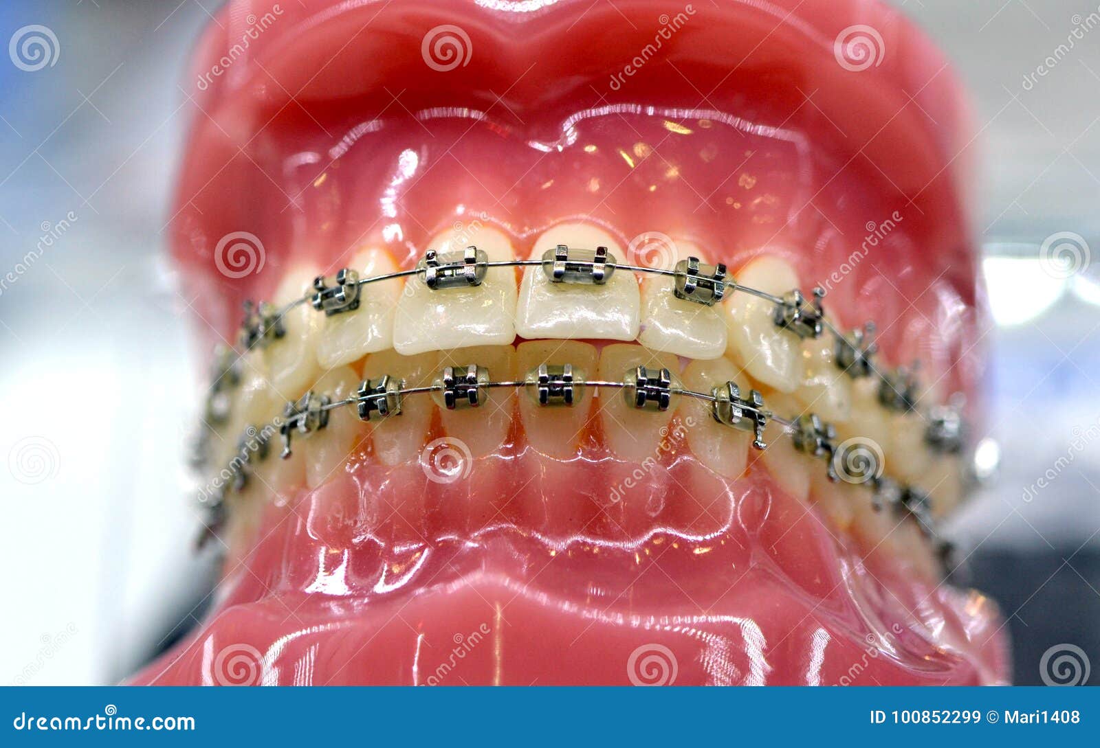 Ganci J SCHEU DENTAL 10 Mm 100 Pz - Foto 11