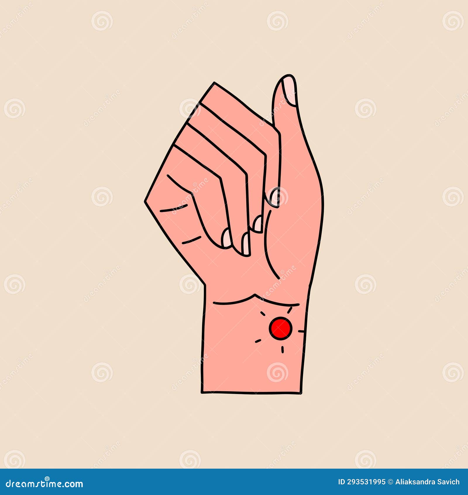 Ganglion Cyst. Fluidfilled Lump Under The Skin Of A Wrist Or Hand