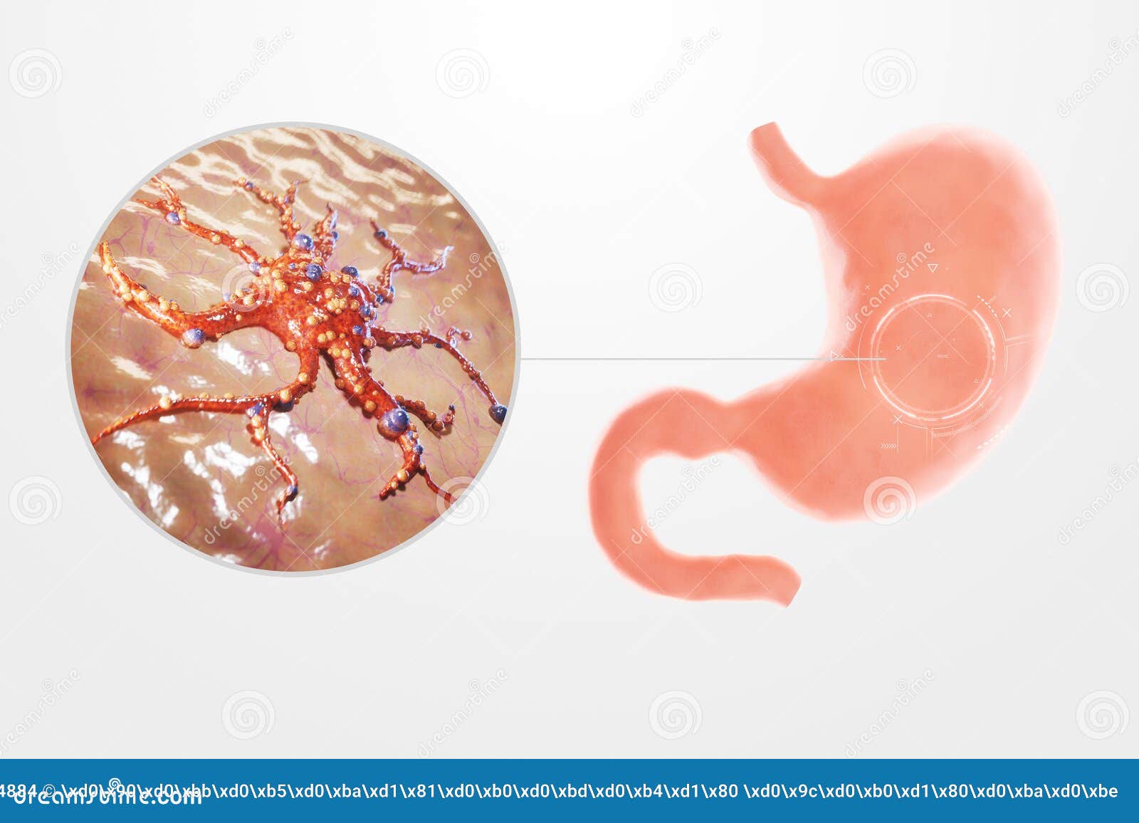 gastric cancer, tumor, human anatomy. concept health care, disease, medicine, biology, chemotherapy. 3d rendering, 3d 