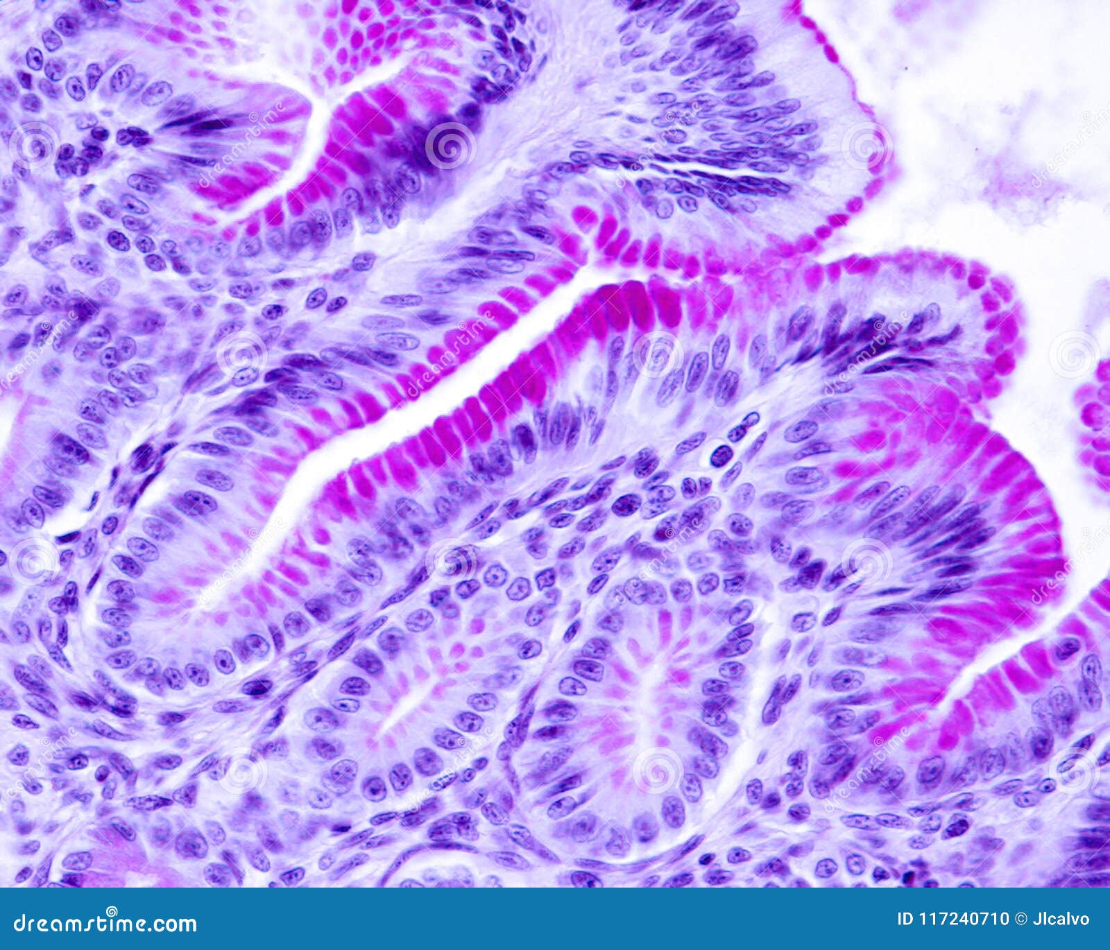 gastric mucosa. epithelium