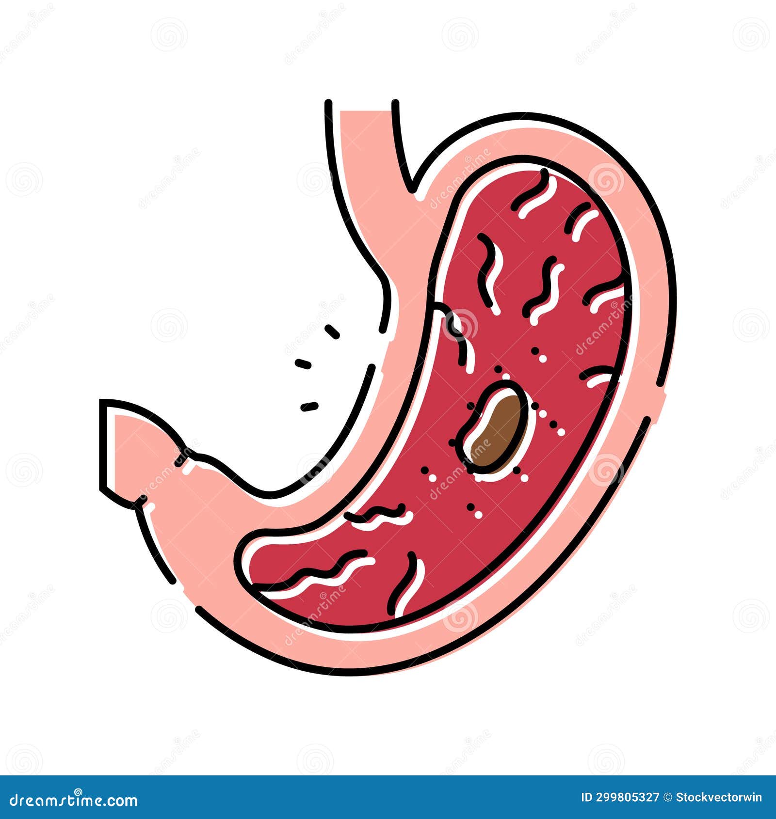 gastric ulcer gastroenterologist color icon  