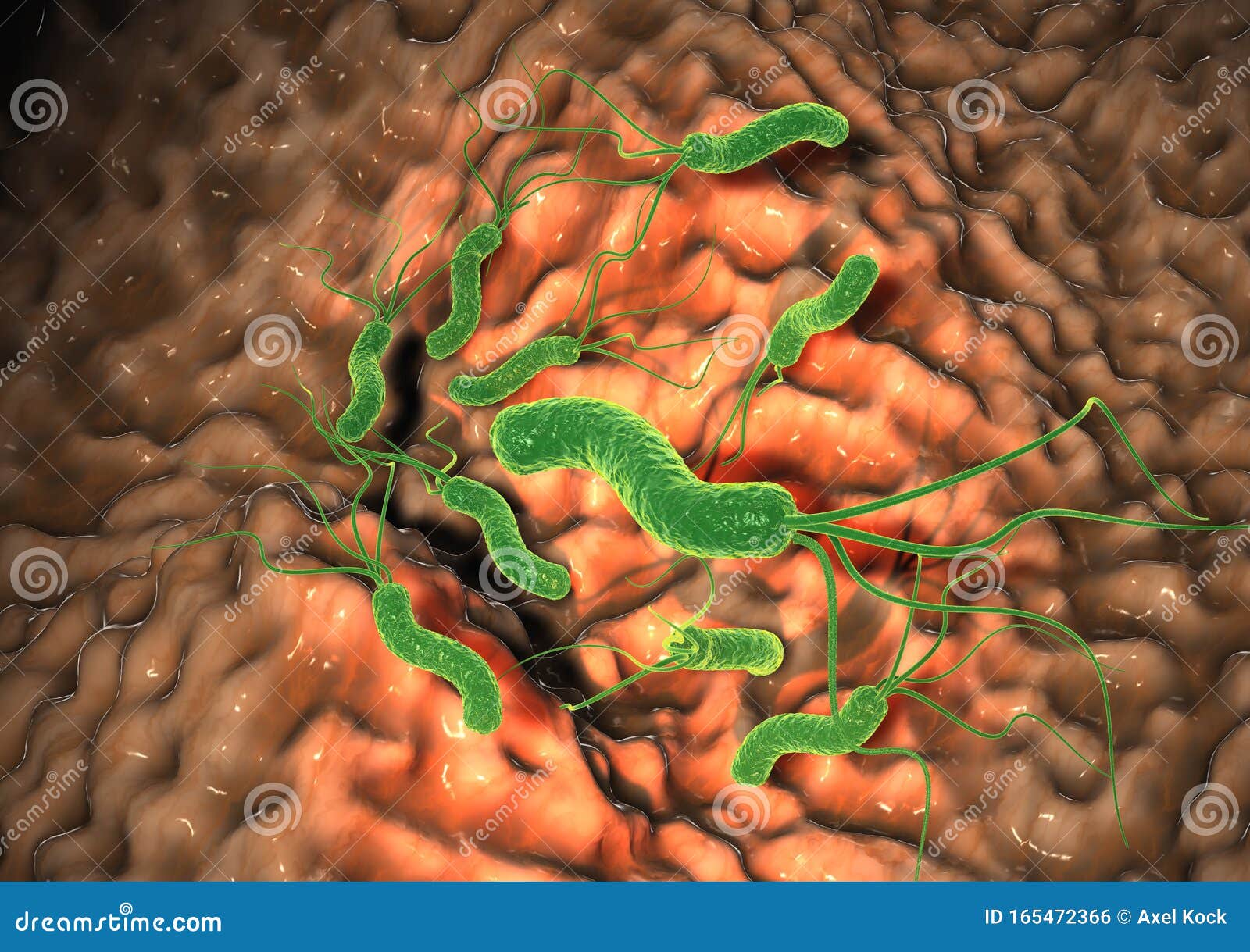 gastritis, helicobacter pylori bacteria damaging mucus layer, medically accurate 3d 