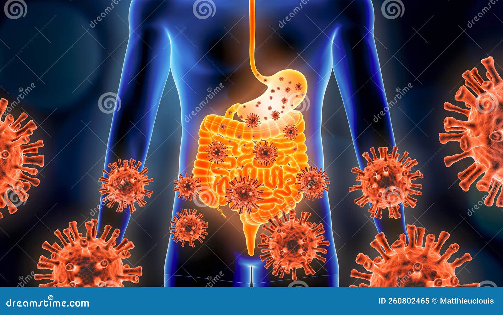 Gastroenteritis of Stomach Flu 3d Rendering Illustration with Red Virus