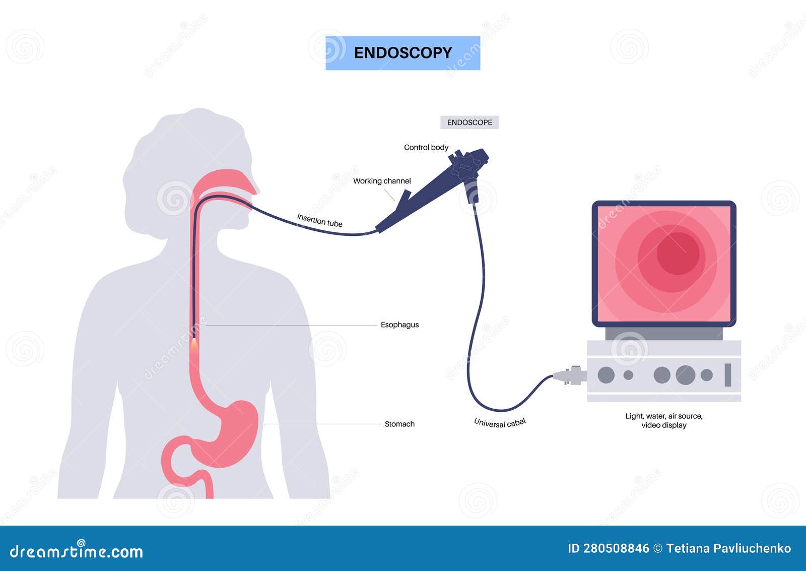 gastroscopy endoscopy procedure