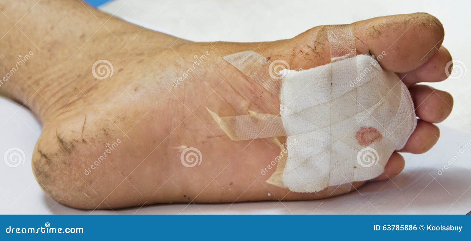 Gauze wound on foot. stock photo. Image of plaster, dressing 63785886