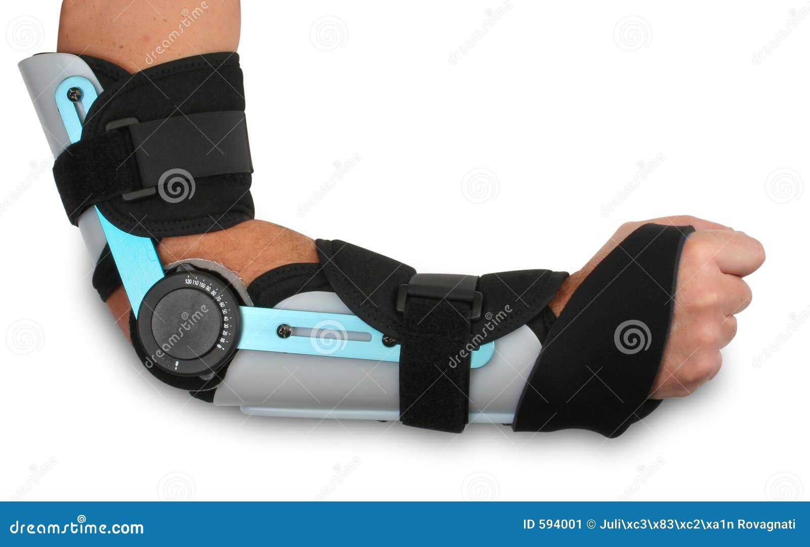 Gebrochener Arm in Einer Form Stockbild Bild von form, schmerz 594001