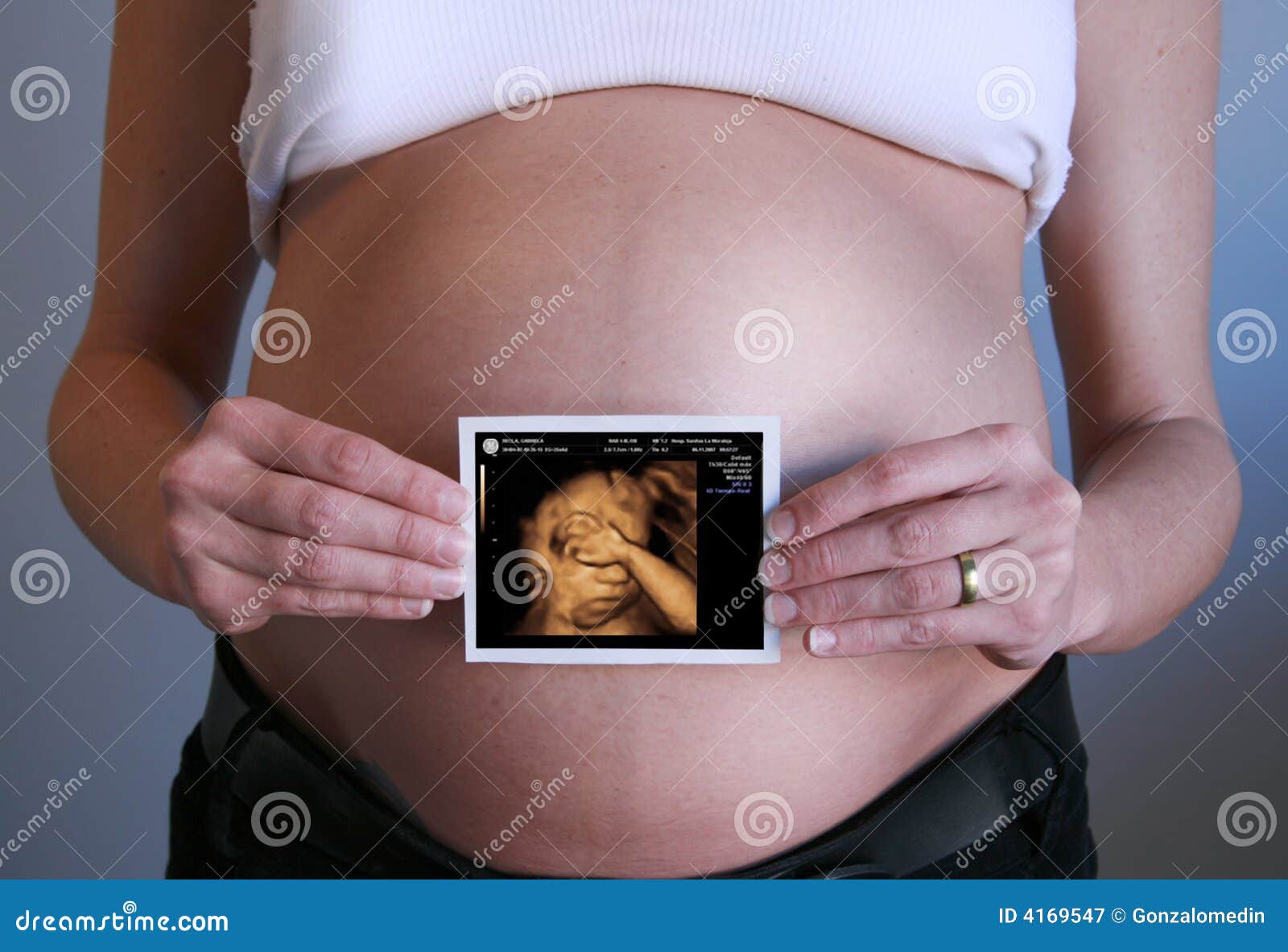 Generacion De Eco Embarazada Del Bebe De La Madre 3d Imagen De Archivo Imagen De Junto Interno Generacion De Eco Embarazada Del Bebe De La Madre 3d Imagen De Archivo Imagen De Junto Interno