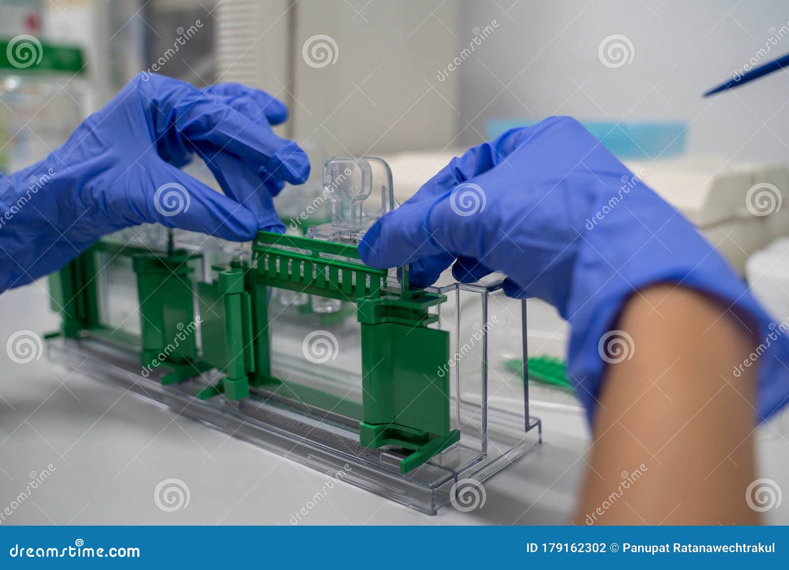 the general process preparation for protein levels detection is using western blot analysis. this method is involved in protein